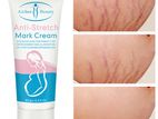 anti stretch mark cream