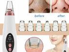 Blackhead Remover 6 in 1 Rechargeable