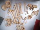 Bones for medical students
