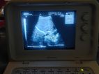 Eden ultrasound