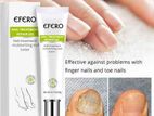 Fungal Removal Nail Treatment