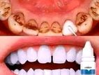 levana teeth whitening