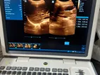 Mindray Dp 30 Ultrasound Machine