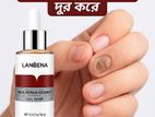 নখের কুনি সমস্যা , ফাঙ্গাস, নখ ফেটে যাওয়া, পুজ পড়া,