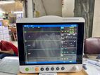 patient monitor 5 parameter