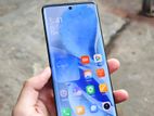 Xiaomi Civi 1s 8+128 অফার🔥 (Used)
